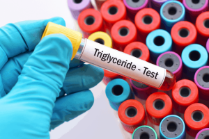 Triglyceride bao nhiêu là bình thường